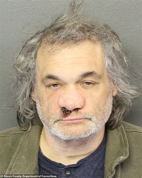 artie lange nose|Comedian Artie Lange says his collapsed nose convinced him to。